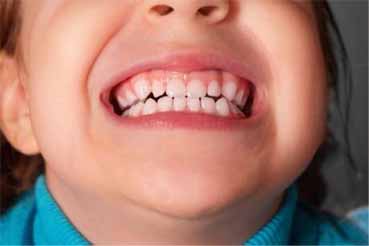ondotologico  Plano Odontológico com Prótese amil dental rede credenciada convenio odontologico   #PlanoOdontológicocomPrótese  #planoondotologico
