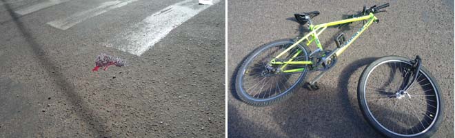 Jovem cai de bicicleta e está em estado grave de saúde