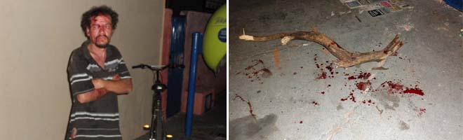 Morador de rua é espancado por suposto grupo de skinheads
