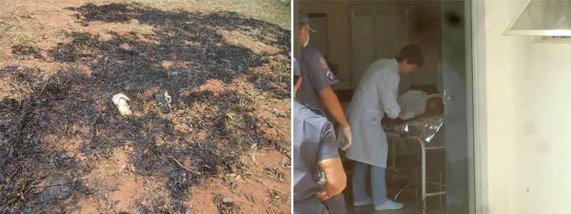 Paraguaçuense morre após colocar fogo em seu próprio corpo