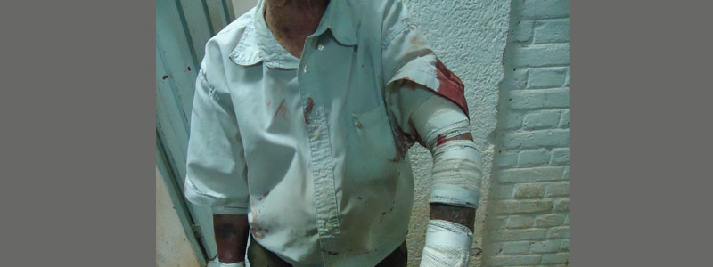 Senhor de 84 anos é agredido pelo filho