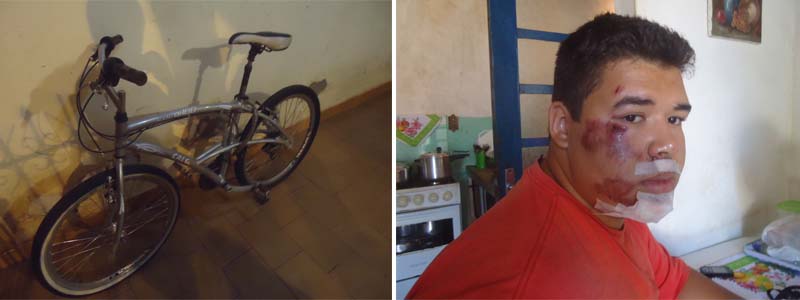 Jovem tem escoriações no rosto após garfo da bicicleta quebrar