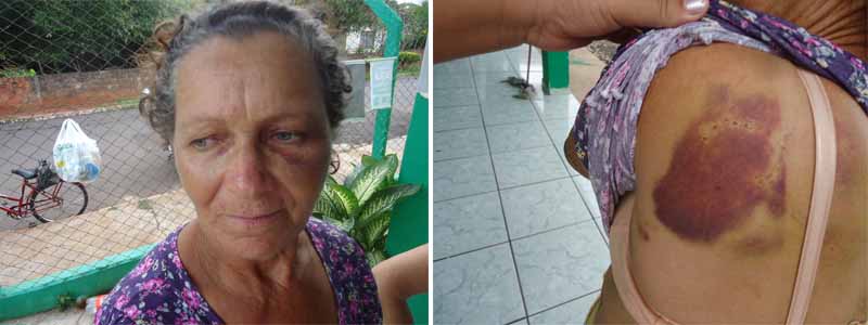 Homem pede moradia para senhora e aguarda momento de distração para espancá-la