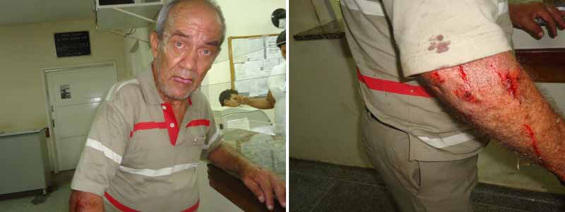 Idoso fica ferido ao ser derrubado e roubado por homens