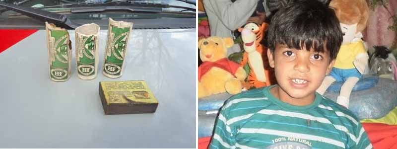 Menino queimado por pólvora está internado no hospital em Bauru