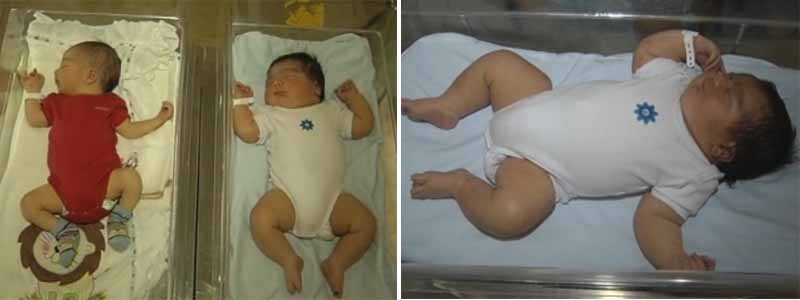 Bebê nasce com 5,6 quilos em maternidade de Assis