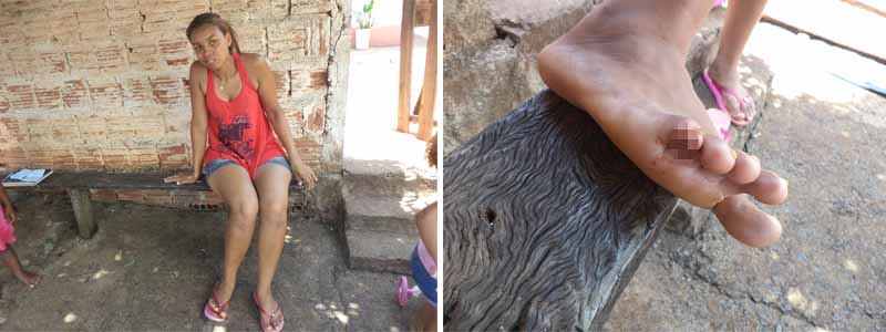 Paraguaçuense é atacada por piranha no balneário de Rancharia