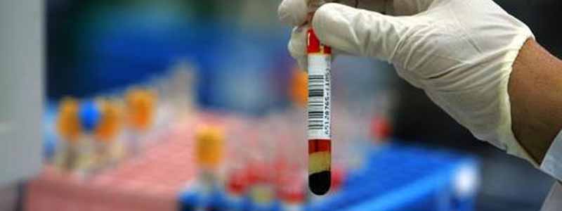 Laboratório Bio-Químico realiza exame que detecta o vírus da dengue em 24 horas