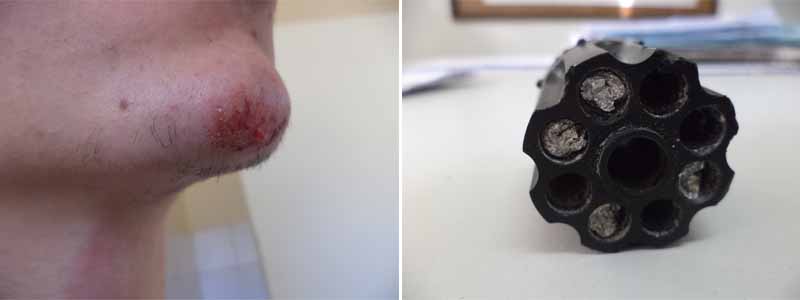 Garoto de 16 anos é agredido durante tentativa de roubo