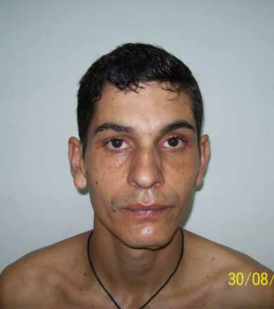 Homem é esfaqueado na Barra Funda, passa por cirurgia, mas foge da Santa Casa