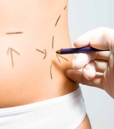 Cirurgia plástica é o novo sonho da classe C