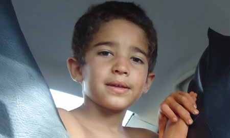 Menino ferido em incêndio tem 95% do corpo queimado e está reagindo ao tratamento