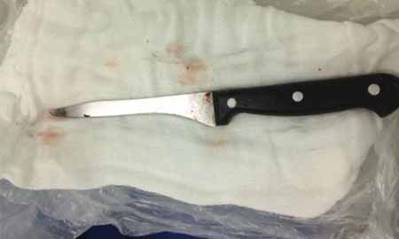 Cirurgião que tirou faca da cabeça de trabalhador diz que vítima teve sorte