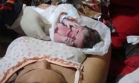 Cabeleireira de 20 anos faz parto de amiga que não sabia de gravidez