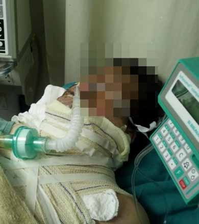 Torcedor que ateou fogo no corpo após derrota do Corinthians não resiste e morre