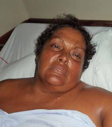 Internada a mais de 70 dias, vítima de brutalidade pede doação de cadeira de rodas
