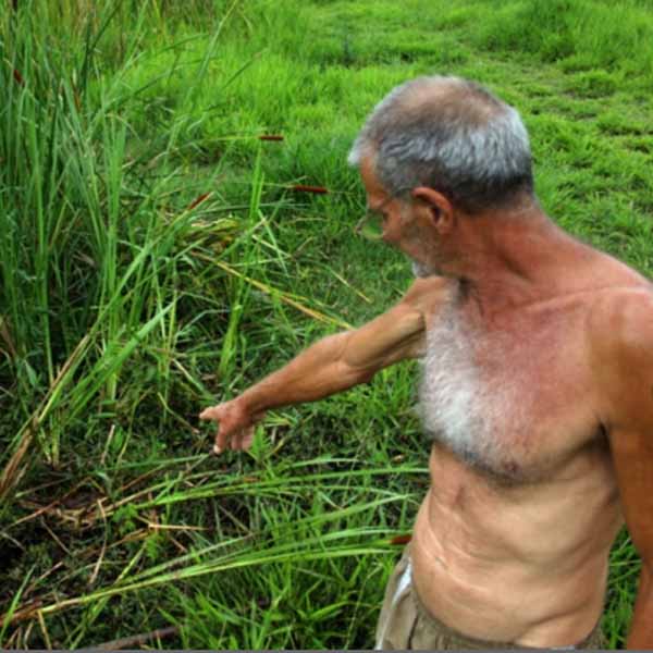 Vítima reage a furto e amputa braço de suspeito com uma foice em Marília