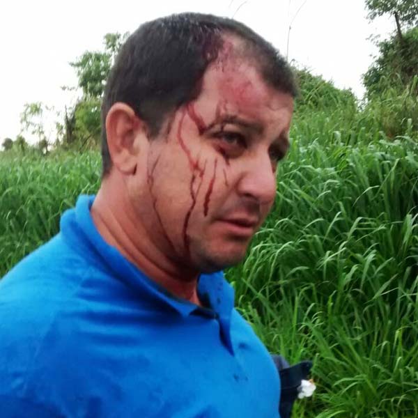 Após caminhão tombar, carreta também se envolve em acidente na 'Prefeito José Gagliard'
