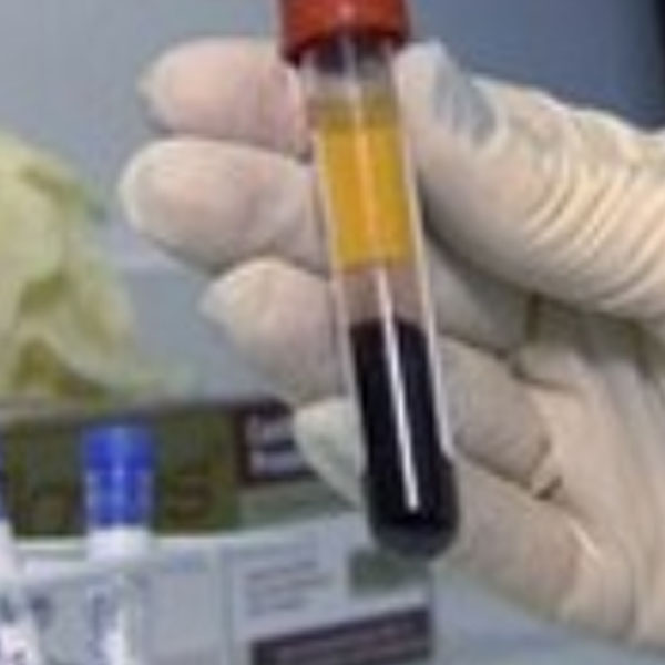 Começa nesta segunda teste que detecta dengue em 20 minutos em SP