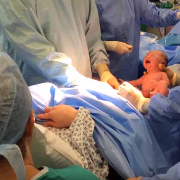 'Cesárea natural' é alternativa para diminuir complicações da cirurgia