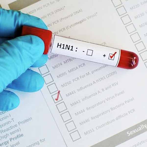 Marília confirma duas mortes causadas pela gripe H1N1