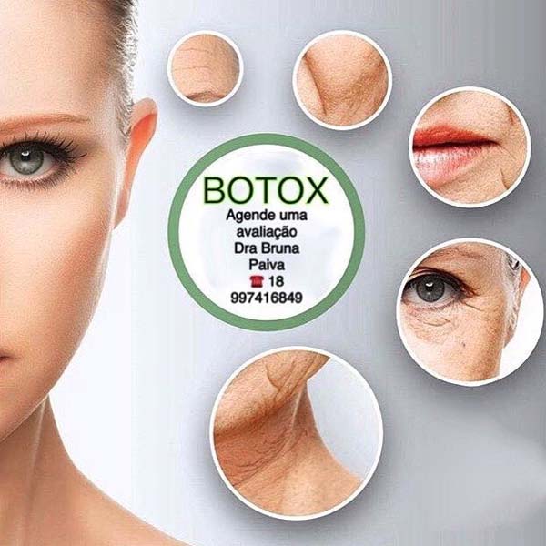 Dra. Bruna Paiva passa a realizar procedimentos para harmonização facial