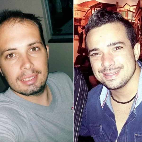 Grave acidente deixa dois mortos na SP-294