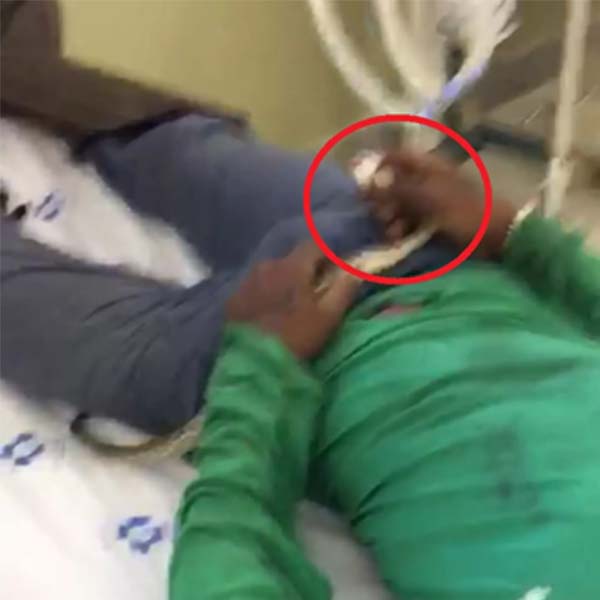 Jardineiro picado por cascavel leva animal até hospital em Marília