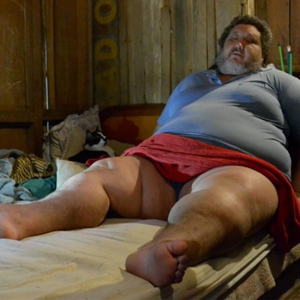 Mariliense com 250 kg vive drama da espera por cirurgia bariátrica