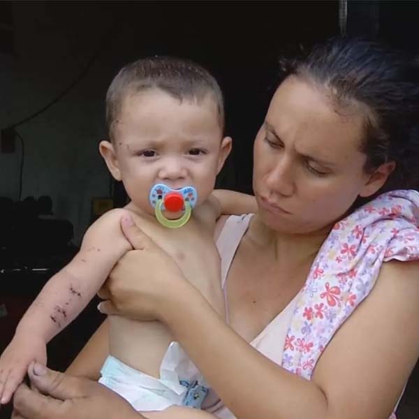 'Quase matou meu menino', diz pai de bebê atacado por macaco em Ourinhos