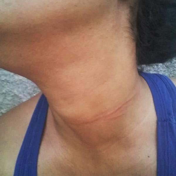 Motociclista fica ferida após ser atingida por linha de pipa em Paraguaçu