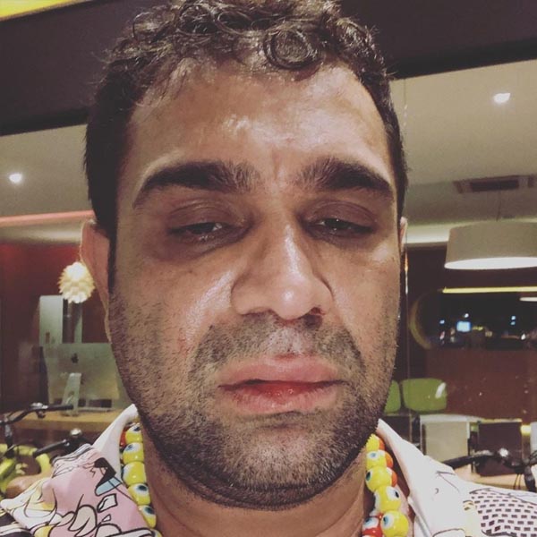 Humorista Evandro Santo é agredido em Marília e fala em homofobia