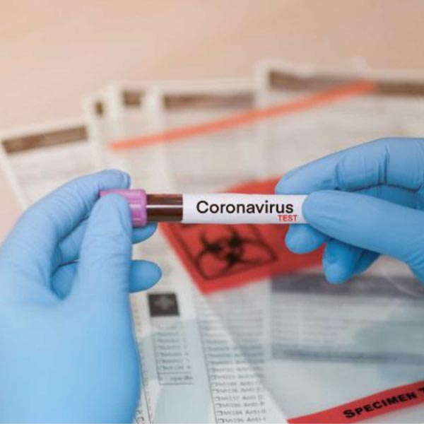 COVID-19: dos casos, 11 foram descartados em Paraguaçu e dois permanecem suspeitos