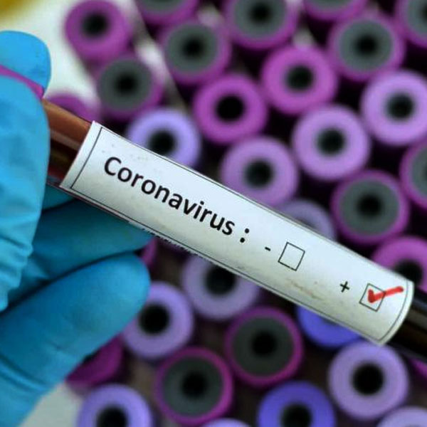 Assis confirma a primeira morte por coronavírus na cidade