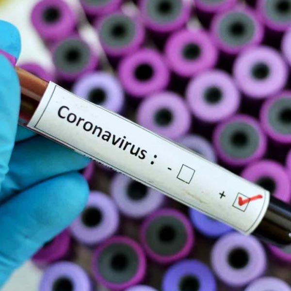 Morador de Iepê morre vítima do novo coronavírus