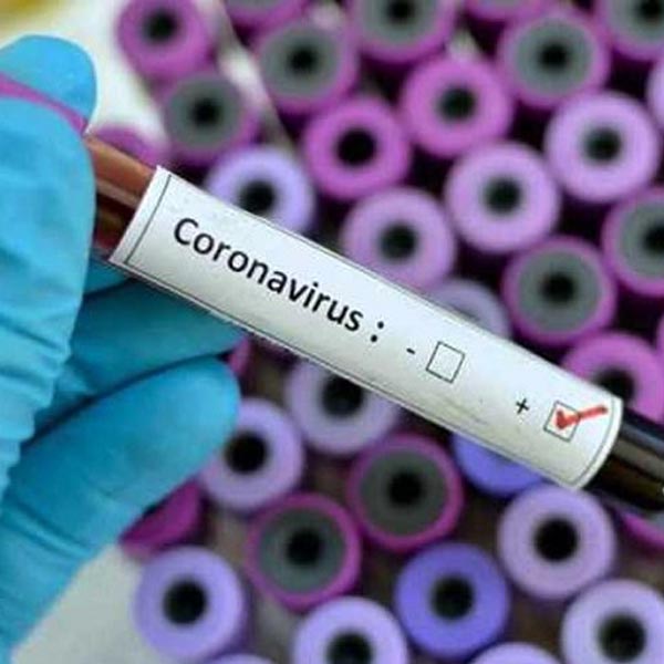 Marília registra primeiro caso positivo da Covid-19