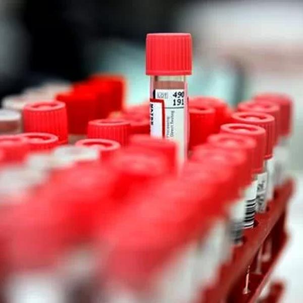 Confirmado o segundo caso positivo de Covid-19 em Paraguaçu