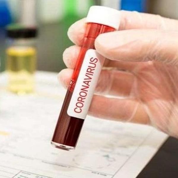 Assis confirma mais quatro casos de COVID-19 nesta quinta-feira, 14