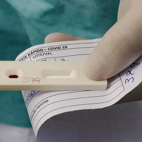 Assis fará de testes rápidos para diagnóstico da Covid-19