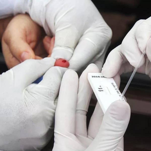 Unimed Assis passa a oferecer cobertura para teste rápido de COVID-19