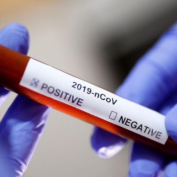 Paraguaçu contabiliza 277 casos positivos e 1.730 casos descartados de coronavírus