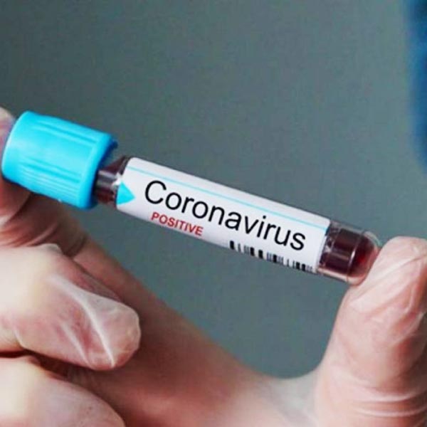 Paraguaçu Paulista se aproxima dos 700 casos confirmados de Covid-19