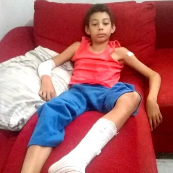 Pai lembra reação ao ver filho pendurado em portão com lança cravada na perna: “Quase morri”