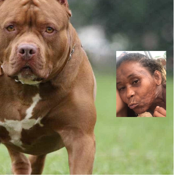 Mulher atacada por pitbulls morre após ficar quatro dias internada
