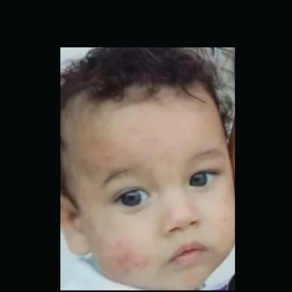 Bebê de um ano esfaqueado pelo próprio pai morre após quase 20 dias internado