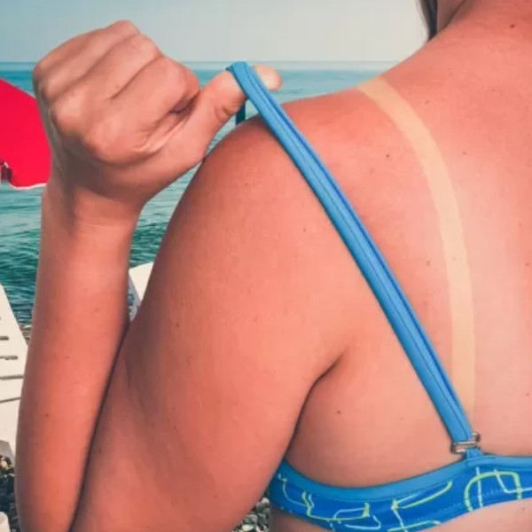 Morte em 24 horas: “golpe de calor” é mais grave que insolação; proteja-se