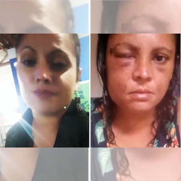 Grávida teve rosto “deformado” após ser espancada por marido