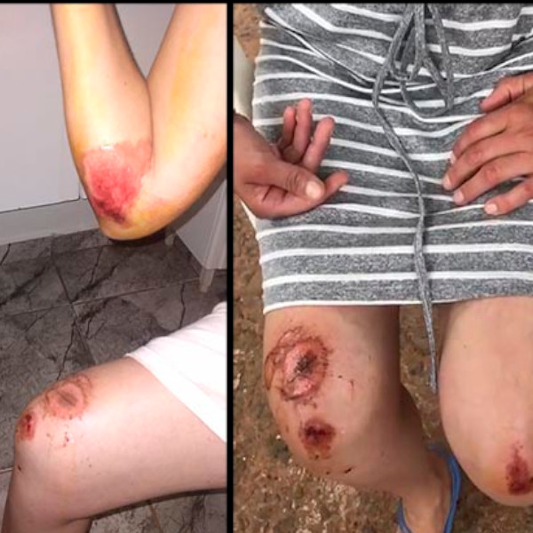 Motorista não presta socorro a mãe e filha após acidente envolvendo carro e moto, em Paraguaçu