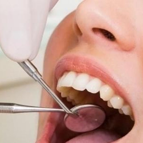 Câncer de boca: cirurgiã-dentista fala sobre a prevenção e o diagnóstico precoce da doença
