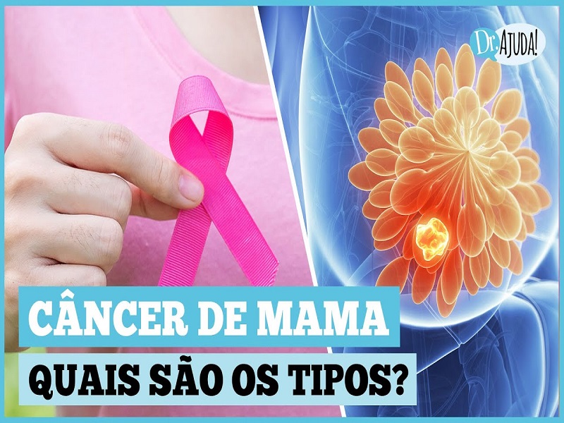Quais são os tipos de câncer de mama?